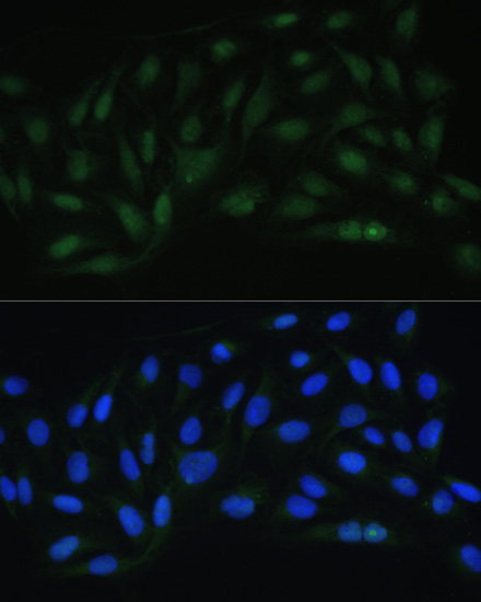 Immunofluorescence - Endothelin 1 Polyclonal Antibody 