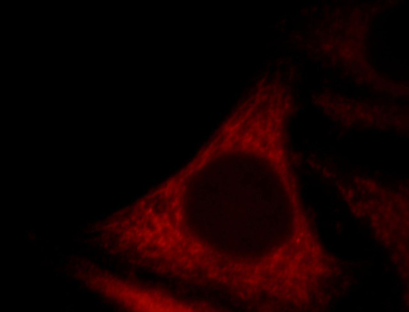 Immunofluorescent analysis of HepG2 cells, using FSD1L antibody Catalog No:110781 at 1:25 dilution and Rhodamine-labeled goat anti-rabbit IgG (red).