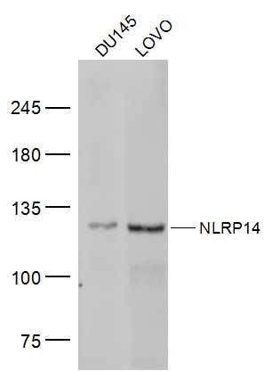 Fig1: Sample:; DU145(Human) Cell Lysate at 30 ug; LOVO(Human) Cell Lysate at 30 ug; Primary: Anti-NLRP14 at 1/300 dilution; Secondary: IRDye800CW Goat Anti-Rabbit IgG at 1/20000 dilution; Predicted band size: 125 kD; Observed band size: 125 kD
