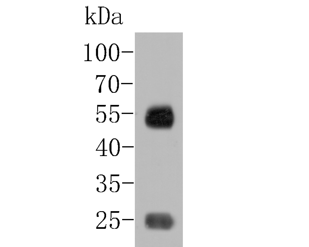 Fig1:; Western blot analysis of IgA on human plasma tissue lysates. Proteins were transferred to a PVDF membrane and blocked with 5% BSA in PBS for 1 hour at room temperature. The primary antibody ( 1/500) was used in 5% BSA at room temperature for 2 hours. Goat Anti-Mouse IgG - HRP Secondary Antibody (HA1006) at 1:5,000 dilution was used for 1 hour at room temperature.