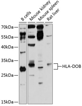 Western blot - HLA-DOB Polyclonal Antibody 