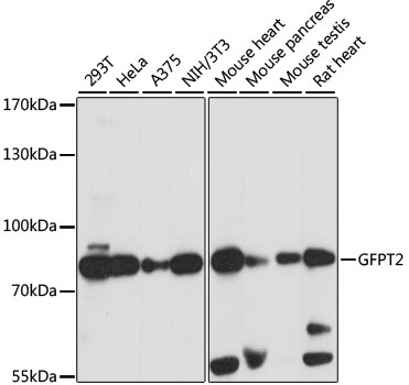 Western blot - GFPT2 Polyclonal Antibody 