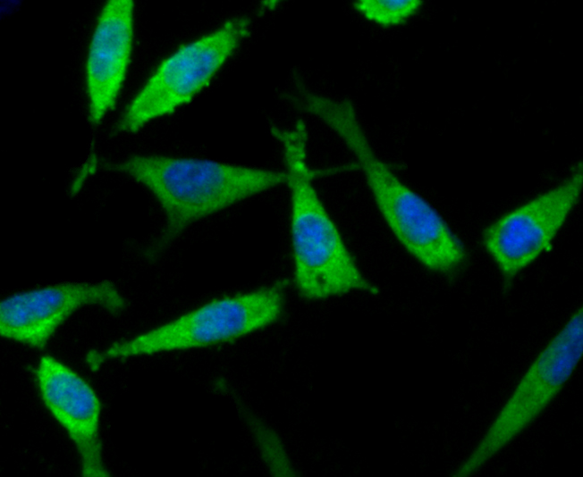 Fig3: ICC staining TGM6 in SH-SY5Y cells (green). The nuclear counter stain is DAPI (blue). Cells were fixed in paraformaldehyde, permeabilised with 0.25% Triton X100/PBS.