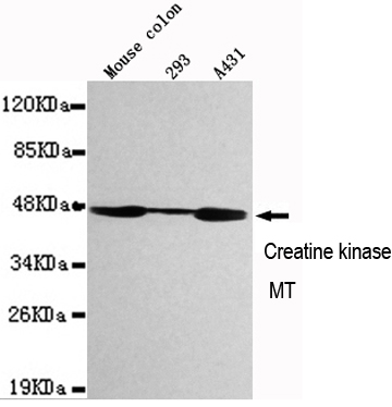 Western blot detection of CKMT1 in Mouse Colon,293 and A431 cell lysates using CKMT1 mouse mAb (1:1000 diluted).Predicted band size:47KDa.Observed band size:47KDa.