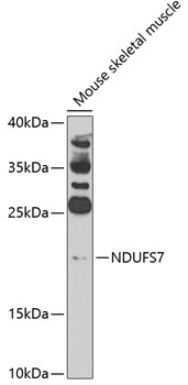Western blot - NDUFS7 Polyclonal Antibody 