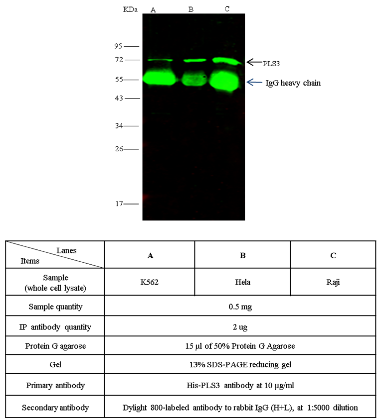 Human PLS3 / Plastin 3 Immunoprecipitation(IP) 14729