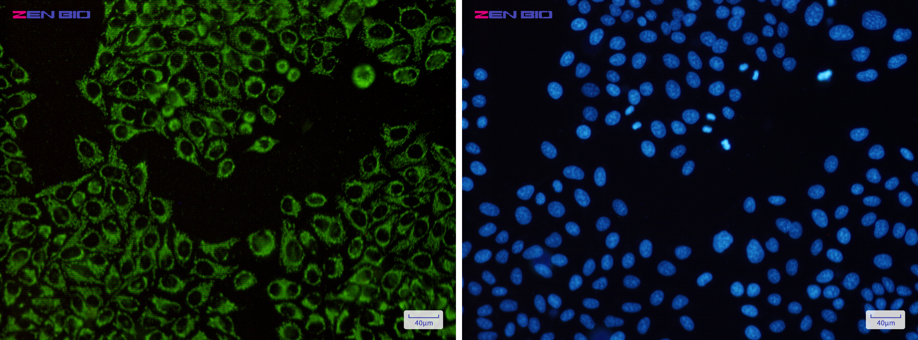 Immunocytochemistry of ATPB(green) in Hela cells using ATPB Rabbit pAb at dilution 1/50, and DAPI(blue)