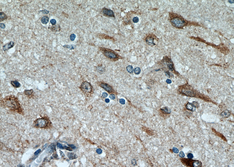 Immunohistochemical of paraffin-embedded human brain using Catalog No:116284(TMX4 antibody) at dilution of 1:50 (under 40x lens)