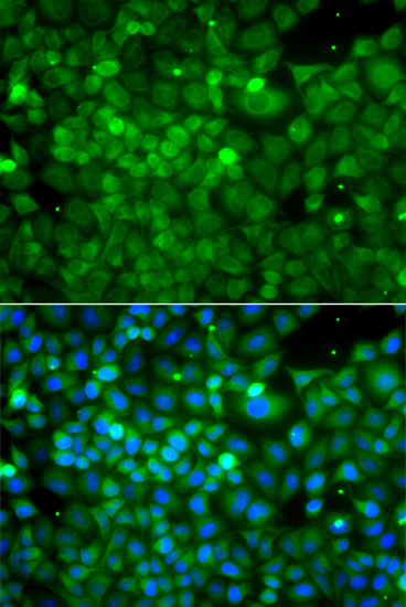 Immunofluorescence - POC1A Polyclonal Antibody 