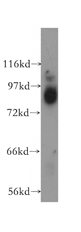 Jurkat cells were subjected to SDS PAGE followed by western blot with Catalog No:107830(EIF2C2 antibody) at dilution of 1:300