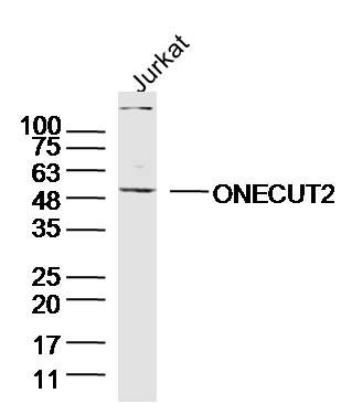 Fig1: Sample:Jurkat(human) Cell Lysate at 40 ug; Primary: Anti-ONECUT2 at 1/300 dilution; Secondary: IRDye800CW Goat Anti-Rabbit IgG at 1/20000 dilution; Predicted band size: 52 kD; Observed band size: 52 kD