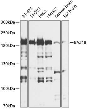 Western blot - BAZ1B Polyclonal Antibody 