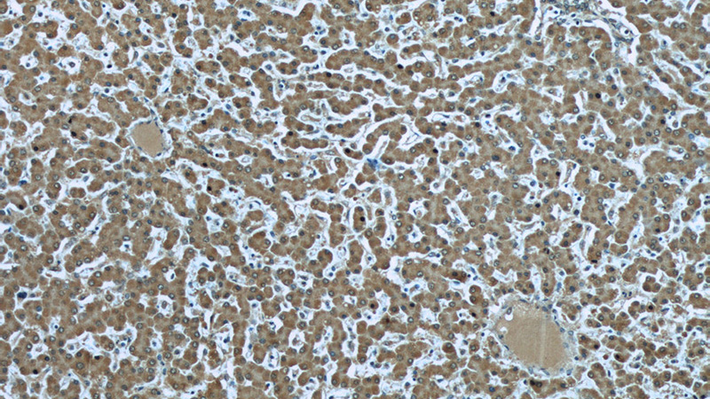 Immunohistochemistry of paraffin-embedded human liver slide using Catalog No:107274(IDS Antibody) at dilution of 1:50