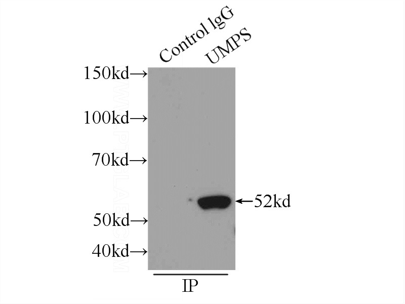 IP Result of anti-UMPS (IP:Catalog No:116570, 3ug; Detection:Catalog No:116570 1:500) with HEK-293 cells lysate 1700ug.