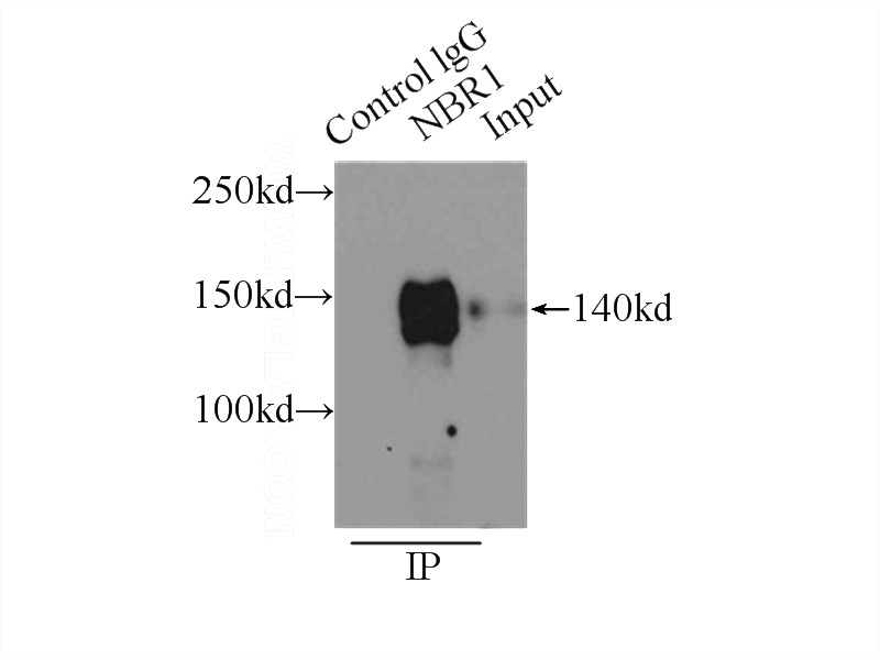 IP Result of anti-NBR1 (IP:Catalog No:113023, 4ug; Detection:Catalog No:113023 1:800) with HeLa cells lysate 2500ug.