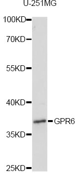Western blot - GPR6 Polyclonal Antibody 