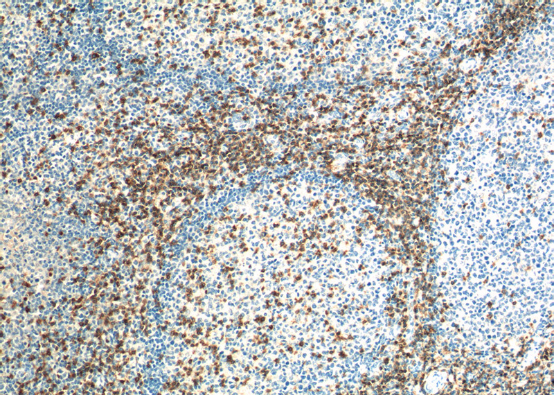 Immunohistochemistry of paraffin-embedded human tonsillitis tissue slide using Catalog No:107129(CD3E Antibody) at dilution of 1:200 (under 10x lens). heat mediated antigen retrieved with Tris-EDTA buffer(pH9).