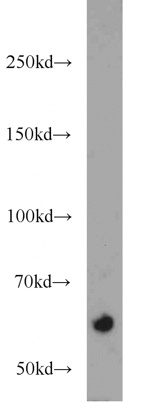 Jurkat cells were subjected to SDS PAGE followed by western blot with Catalog No:114494(RABEP2 antibody) at dilution of 1:1000