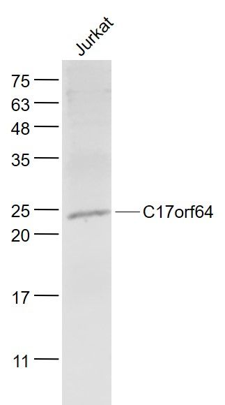 Fig2: Sample:; Jurkat(Human) Cell Lysate at 30 ug; Primary: Anti- C17orf64 at 1/1000 dilution; Secondary: IRDye800CW Goat Anti-Rabbit IgG at 1/20000 dilution; Predicted band size: 27 kD; Observed band size: 25 kD