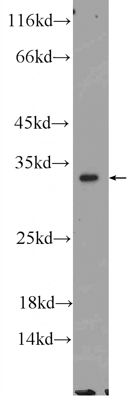 mouse brain tissue were subjected to SDS PAGE followed by western blot with Catalog No:115328(SLC25A22 Antibody) at dilution of 1:1000