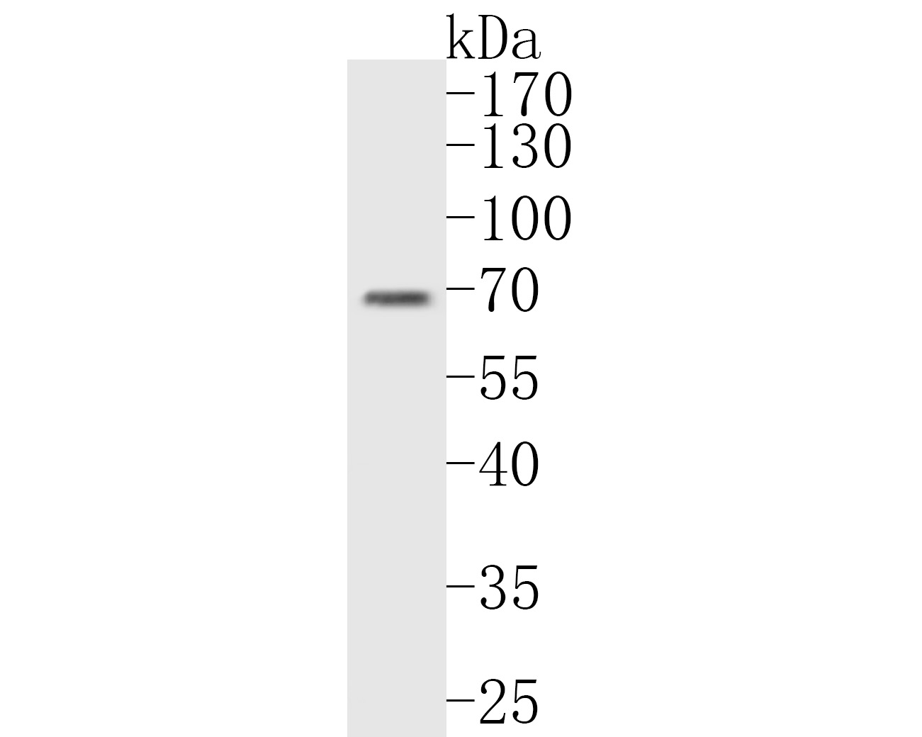 Fig1:; Western blot analysis of GATAD2A on MCF-7 cell lysates. Proteins were transferred to a PVDF membrane and blocked with 5% BSA in PBS for 1 hour at room temperature. The primary antibody ( 1/1,000) was used in 5% BSA at room temperature for 2 hours. Goat Anti-Rabbit IgG - HRP Secondary Antibody (HA1001) at 1:5,000 dilution was used for 1 hour at room temperature.