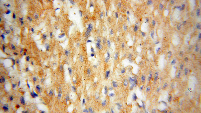 Immunohistochemical of paraffin-embedded human heart using Catalog No:113035(NCF4 antibody) at dilution of 1:50 (under 40x lens)