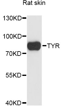 Western blot - TYR Polyclonal Antibody 