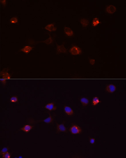 Immunofluorescence - DEFB4A Polyclonal Antibody 