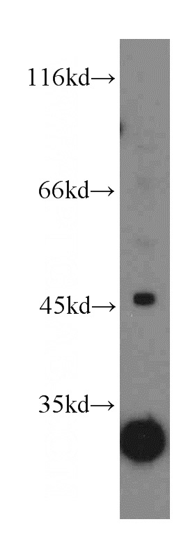 mouse brain tissue were subjected to SDS PAGE followed by western blot with Catalog No:112139(LANCL1 antibody) at dilution of 1:300