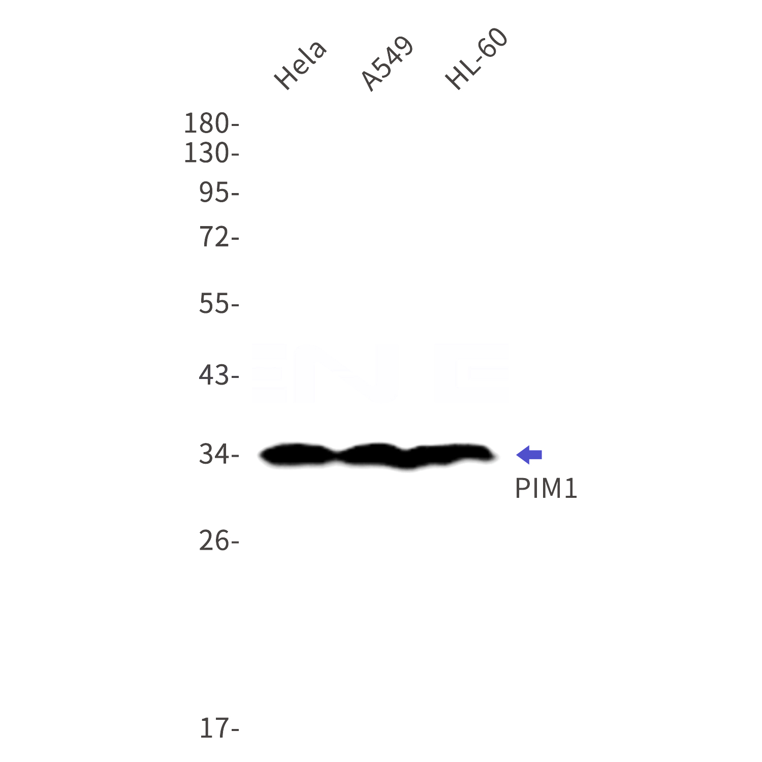 Western blot detection of PIM1 in Hela,A549,HL-60 cell lysates using PIM1 Rabbit mAb(1:1000 diluted).Predicted band size:45kDa.Observed band size:34kDa.