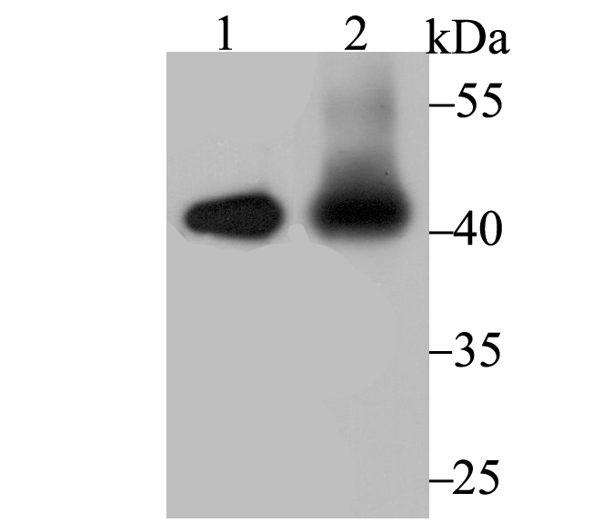 Fig1:; Western blot analysis of IL12B on different lysates. Proteins were transferred to a PVDF membrane and blocked with 5% BSA in PBS for 1 hour at room temperature. The primary antibody ( 1/500) was used in 5% BSA at room temperature for 2 hours. Goat Anti-Rabbit IgG - HRP Secondary Antibody (HA1001) at 1:5,000 dilution was used for 1 hour at room temperature.; Positive control:; Lane 1: Hela cell lysates; Lane 2: Mouse placenta tissue lysates