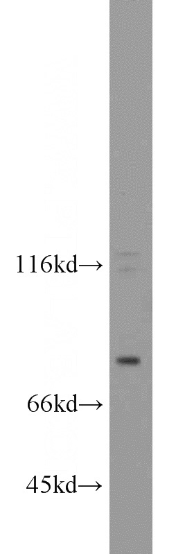 DU 145 cells were subjected to SDS PAGE followed by western blot with Catalog No:110783(FSHR antibody) at dilution of 1:1000