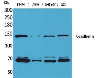 Fig1:; Western Blot analysis of BT474, A549, SHSY5Y, 293 cells using K-cadherin Polyclonal Antibody.. Secondary antibody（catalog#：HA1001) was diluted at 1:20000