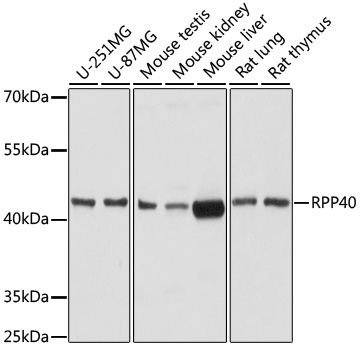 Western blot - RPP40 Polyclonal Antibody 