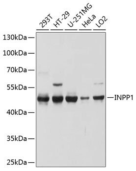 Western blot - INPP1 Polyclonal Antibody 