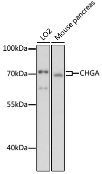 Western blot - CHGA Polyclonal Antibody 