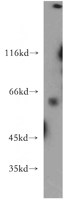 human brain tissue were subjected to SDS PAGE followed by western blot with Catalog No:109688(CYP26B1 antibody) at dilution of 1:500