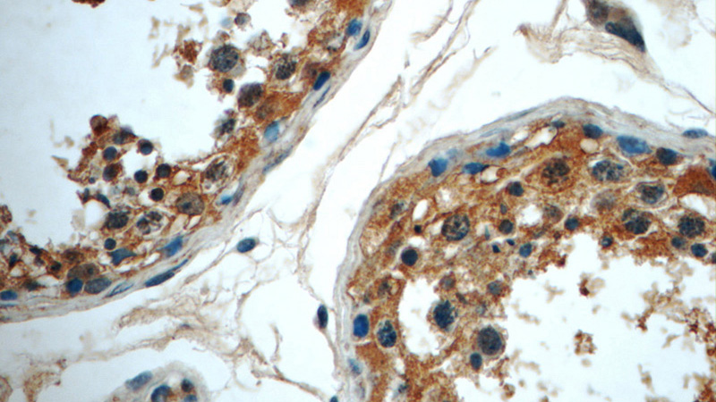 Immunohistochemistry of paraffin-embedded human testis tissue slide using Catalog No:114896(RPL39L Antibody) at dilution of 1:50 (under 40x lens)