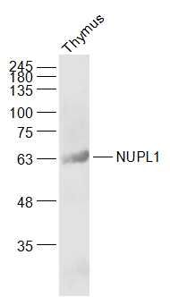 Fig1: Sample:; Thymus (Rat) Lysate at 40 ug; Primary: Anti-NUPL1 at 1/1000 dilution; Secondary: IRDye800CW Goat Anti-Rabbit IgG at 1/20000 dilution; Predicted band size: 61 kD; Observed band size: 63 kD