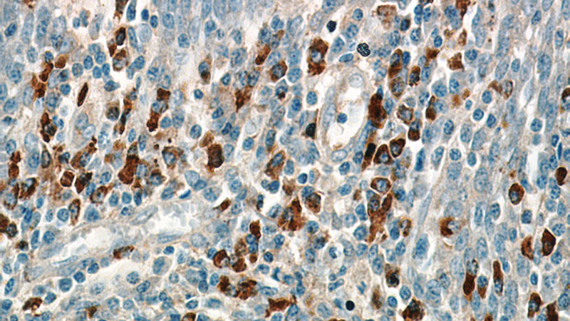 Immunohistochemical of paraffin-embedded human tonsil using Catalog No:107270(IGHA1 antibody) at dilution of 1:50 (under 40x lens)