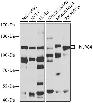 Western blot - NLRC4 Polyclonal Antibody 