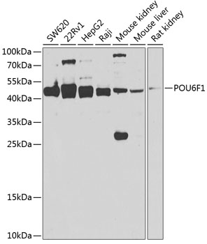 Western blot - POU6F1 Polyclonal Antibody 