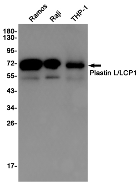 Western blot detection of Plastin L/LCP1 in Ramos,Raji,THP1 cell lysates using Plastin L/LCP1 Rabbit pAb(1:1000 diluted).Predicted band size:70KDa.Observed band size:70KDa.