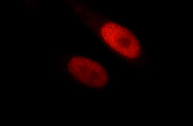 Immunofluorescent analysis of HepG2 cells, using HDAC2 antibody Catalog No:111373 at 1:25 dilution and Rhodamine-labeled goat anti-rabbit IgG (red).