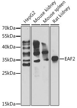 Western blot - EAF2 Polyclonal Antibody 