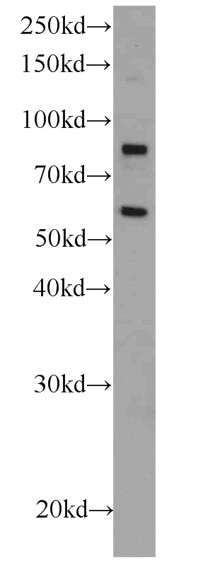 HEK-293 cells were subjected to SDS PAGE followed by western blot with Catalog No:115166(SGK1 antibody) at dilution of 1:800