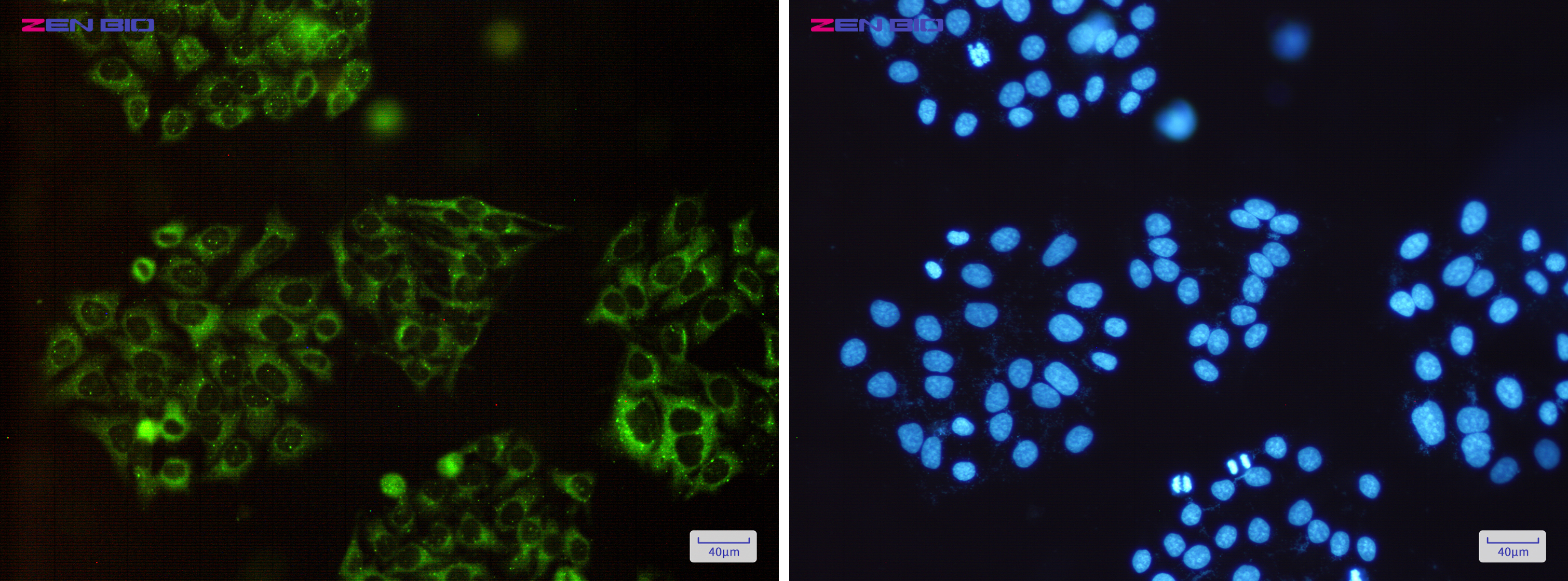 Immunocytochemistry of SQSTM1/p62(green) in Hela cells using SQSTM1/p62 Rabbit pAb at dilution 1/50, and DAPI(blue)