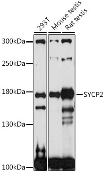 Western blot - SYCP2 Polyclonal Antibody 