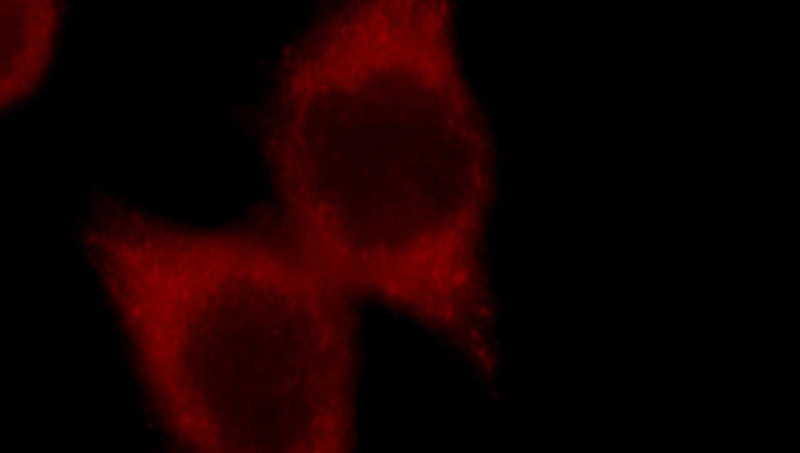 Immunofluorescent analysis of MCF-7 cells, using GSK3B antibody Catalog No:111169 at 1:50 dilution and Rhodamine-labeled goat anti-rabbit IgG (red).
