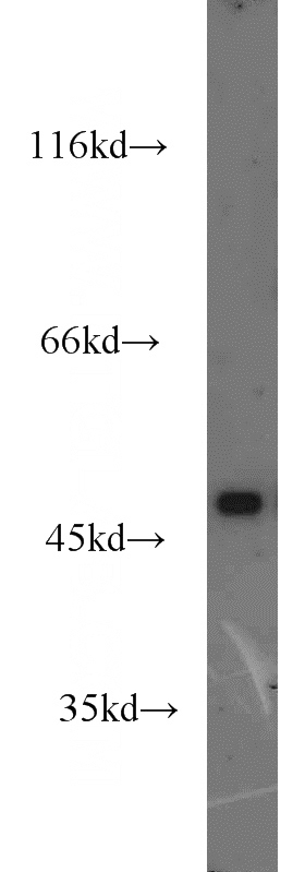 SH-SY5Y cells were subjected to SDS PAGE followed by western blot with Catalog No:110015(DRD1 antibody) at dilution of 1:1000